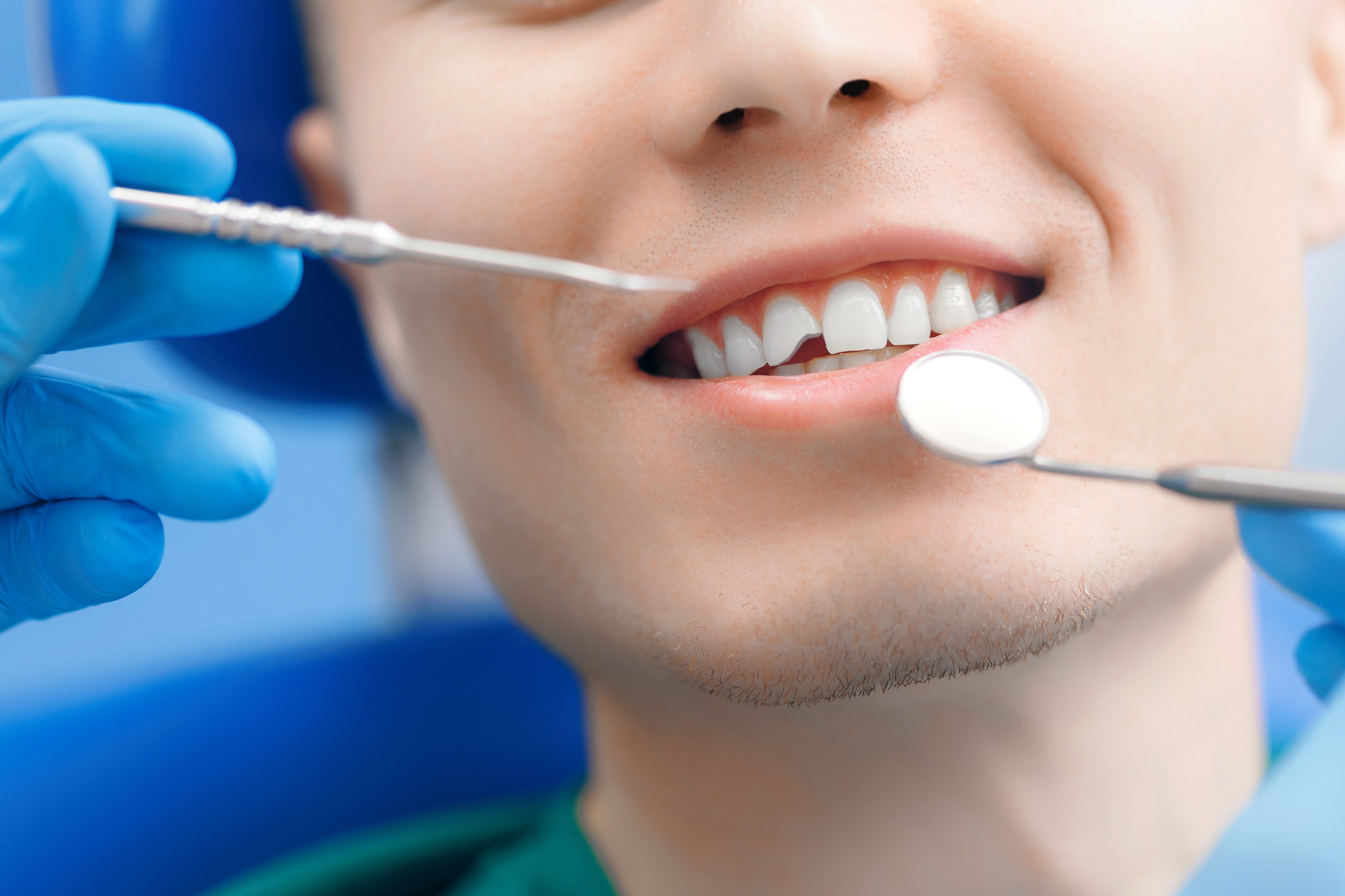 Broken Tooth Repair
