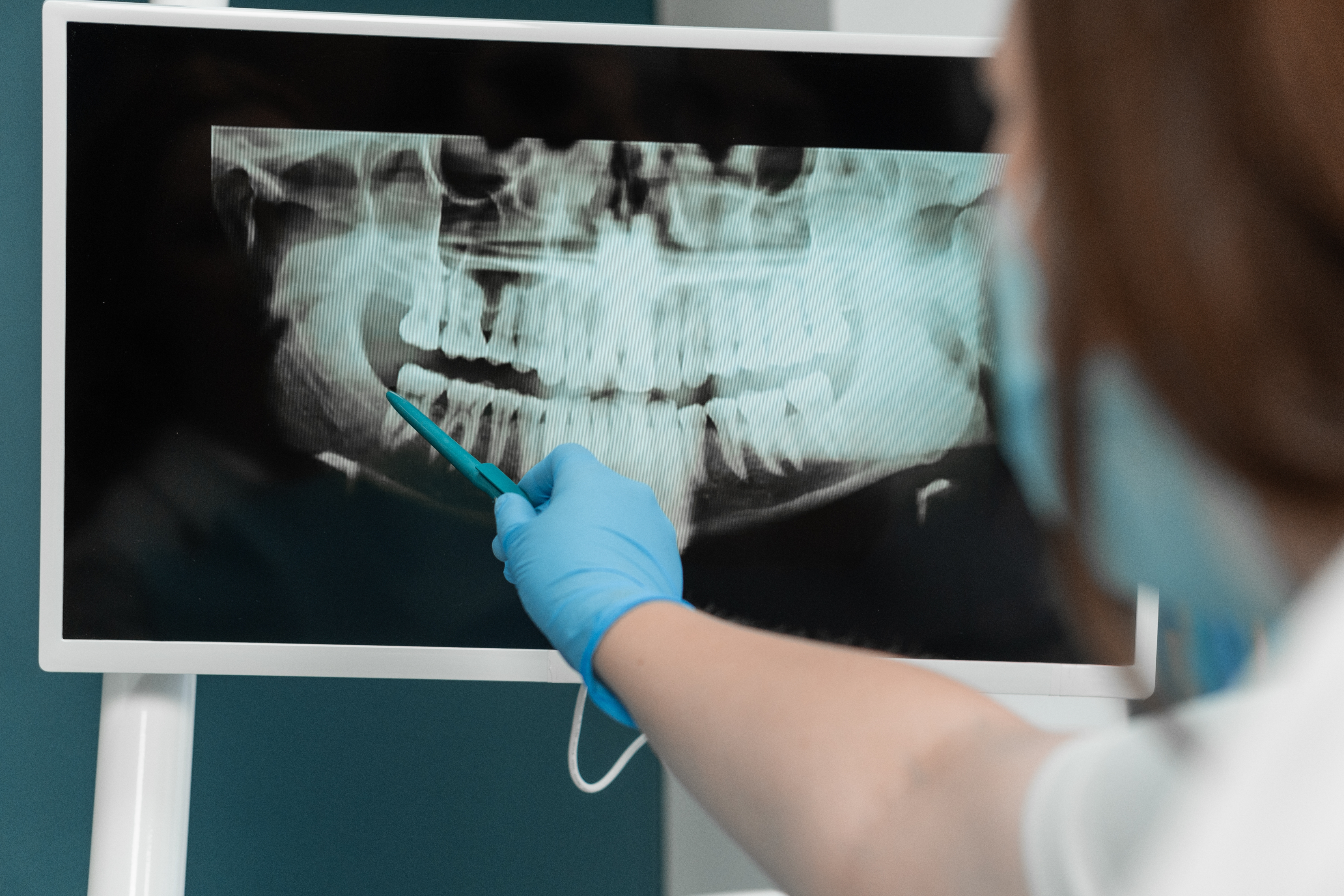 X-Rays & Imaging